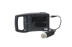 Ultralydsscanner
